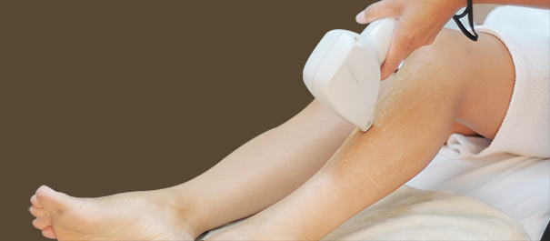epilation laser
