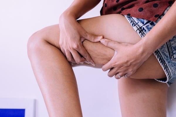 Femme pinçant un pli de peau entre ses doigts et son pouce pour voir sa cellulite