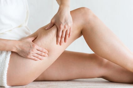 cellulite homme