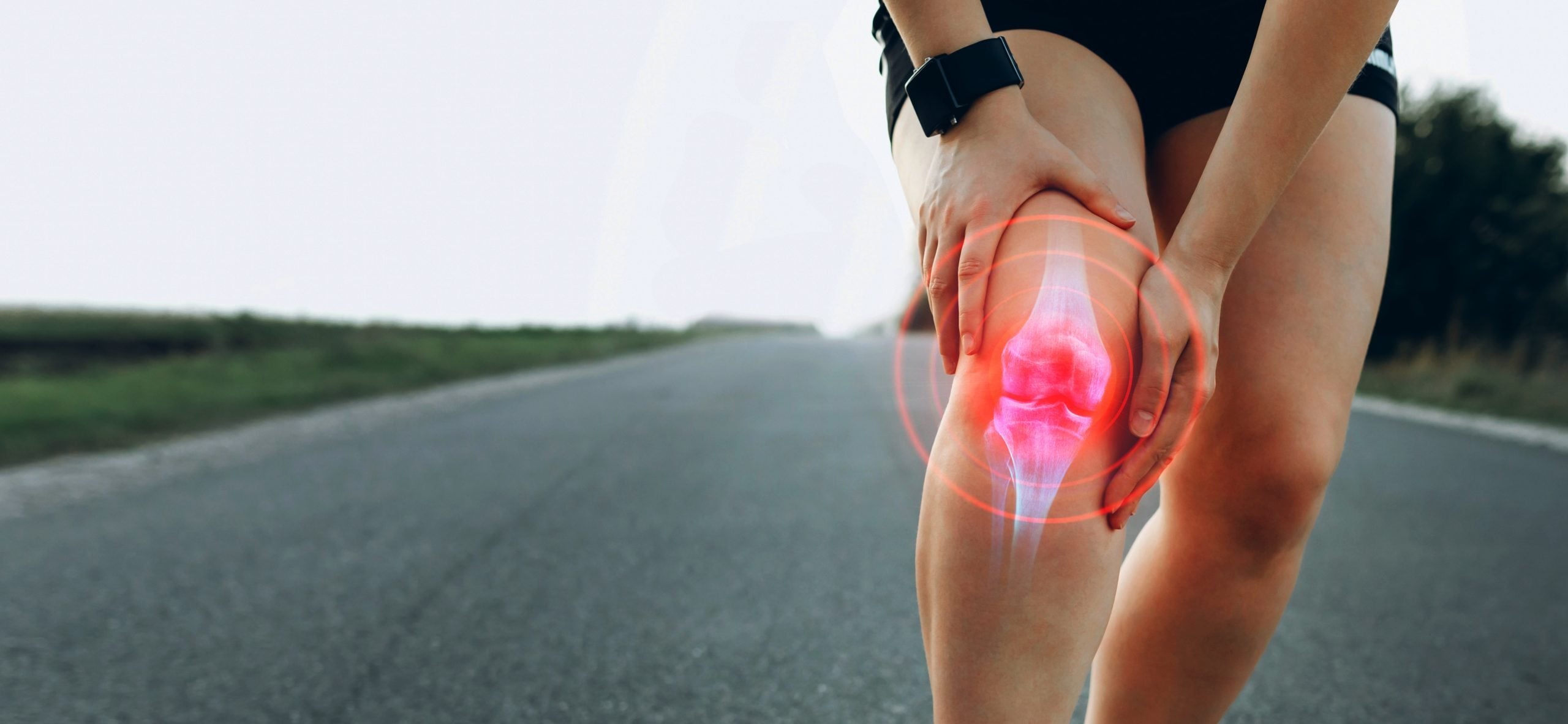 arthrose dans jambe