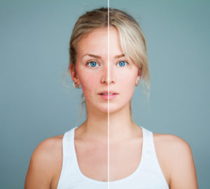 Rougeur au visage